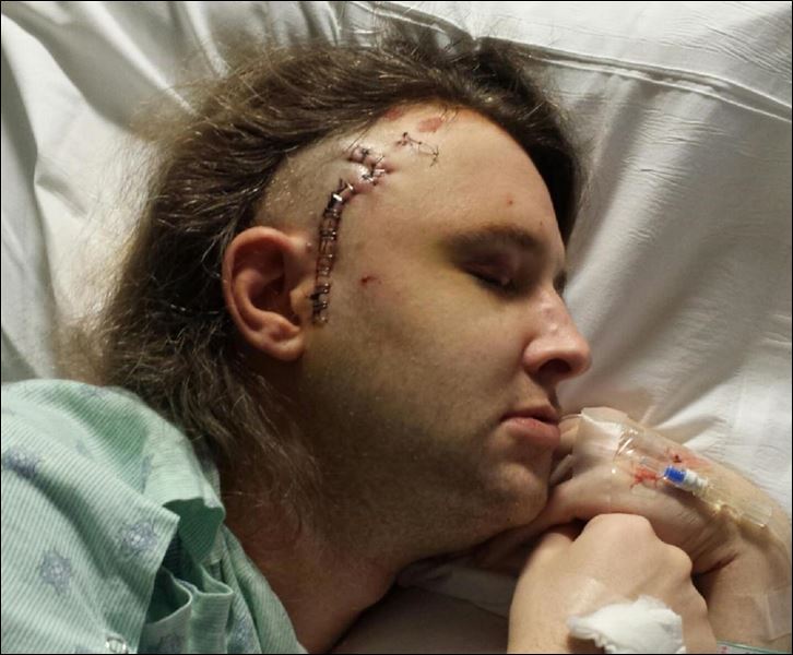 Candice Rose Milligan, a transgender woman who was attacked in Toledo on Monday. Ms. Milligan has undergone 2 surgeries, and her jaw has been wired shut. - 20141106-125337-jpg