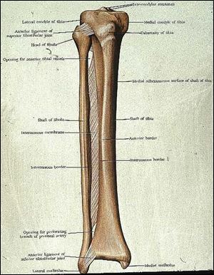 The tibia and fibula are the bones that run from the knee to the ankle. I broke the skinnier of the two, the fibula, down by the ankle.