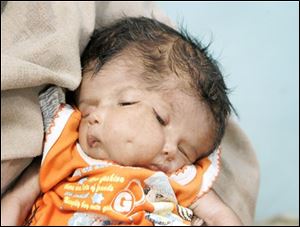 Mother Sushma holds her daughter Lali at their residence in Saini Sunpura, 50 kilometers east of New Delhi, India on Tuesday. The baby with two faces, two noses, two pairs of lips and two pairs of eyes was born on March 11 in a northern Indian village, where she is doing well and is being worshipped as the reincarnation of a Hindu goddess, her father said Tuesday. 