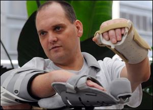 Chris Pollock, 41, who lost his hands in a corn picker at a friend's farm in 2008, is the nation's first recipient of an above-the-elbow hand transplant.