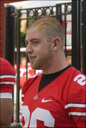 Tyler Moeller (seen last season) had lacerations from an off-campus assault stapled shut on his head. 
