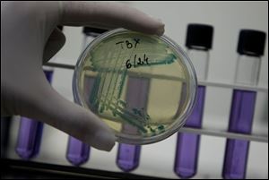 A laboratory technician shows isolated E. coli bacteria at the Bulgarian Food Safety Agency's micro biological laboratory in Sofia, Bulgaria on Friday. German vegetables caused an E. coli outbreak that has killed 29 people and sickened 3,000, investigators announced Friday after tracking the bacteria from patients in hospital beds to restaurants and then farm fields.