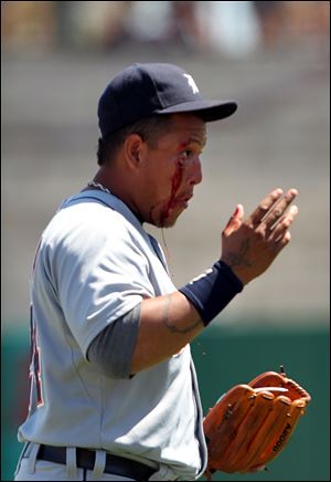 Miguel Cabrera had stitches after being struck by a ball hit by Hunter Pence.