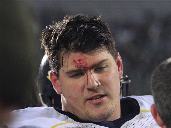 Michigan's Taylor Lewan apologizes for facemask twist against Spartans 