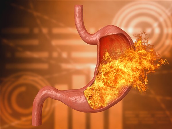 The problem of gastroesophageal reflux disease should not go